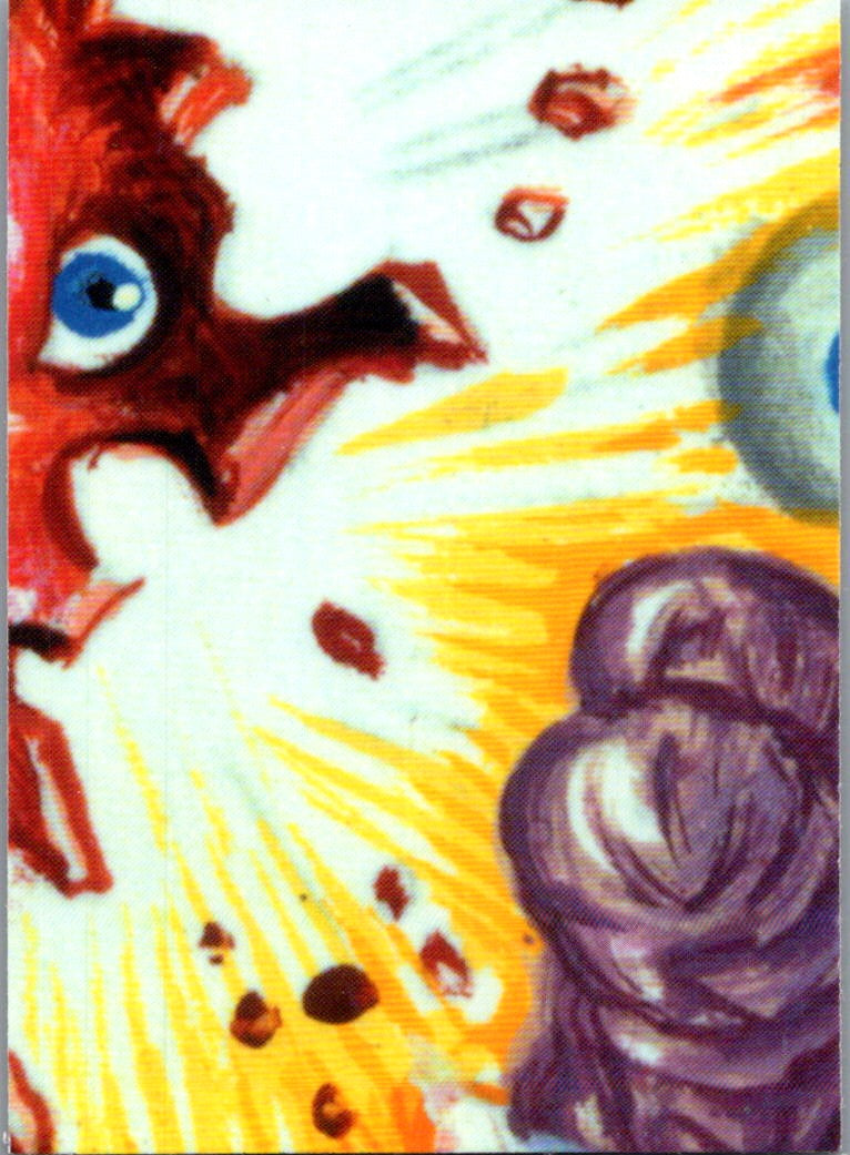 1986 Topps Garbage Pail Kids Series 6 Nasel Hazel Sticker #225a