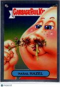 1986 Topps Garbage Pail Kids Series 6 Nasel Hazel Sticker #225a